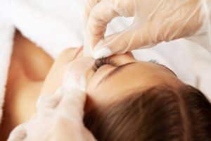 Blépharoplastie
